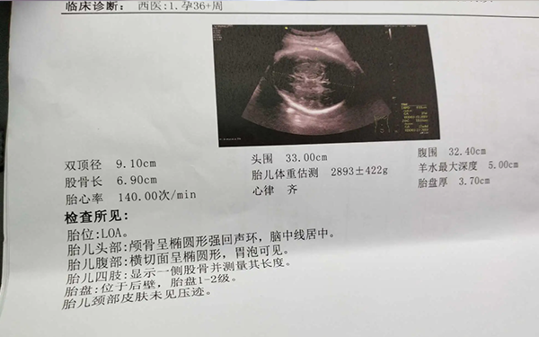 孕31周B超双顶径80mm代表胎儿多少斤?